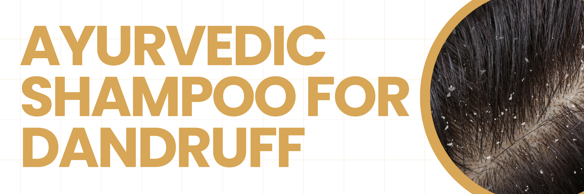 Why Choose Ayurvedic Shampoo for Dandruff